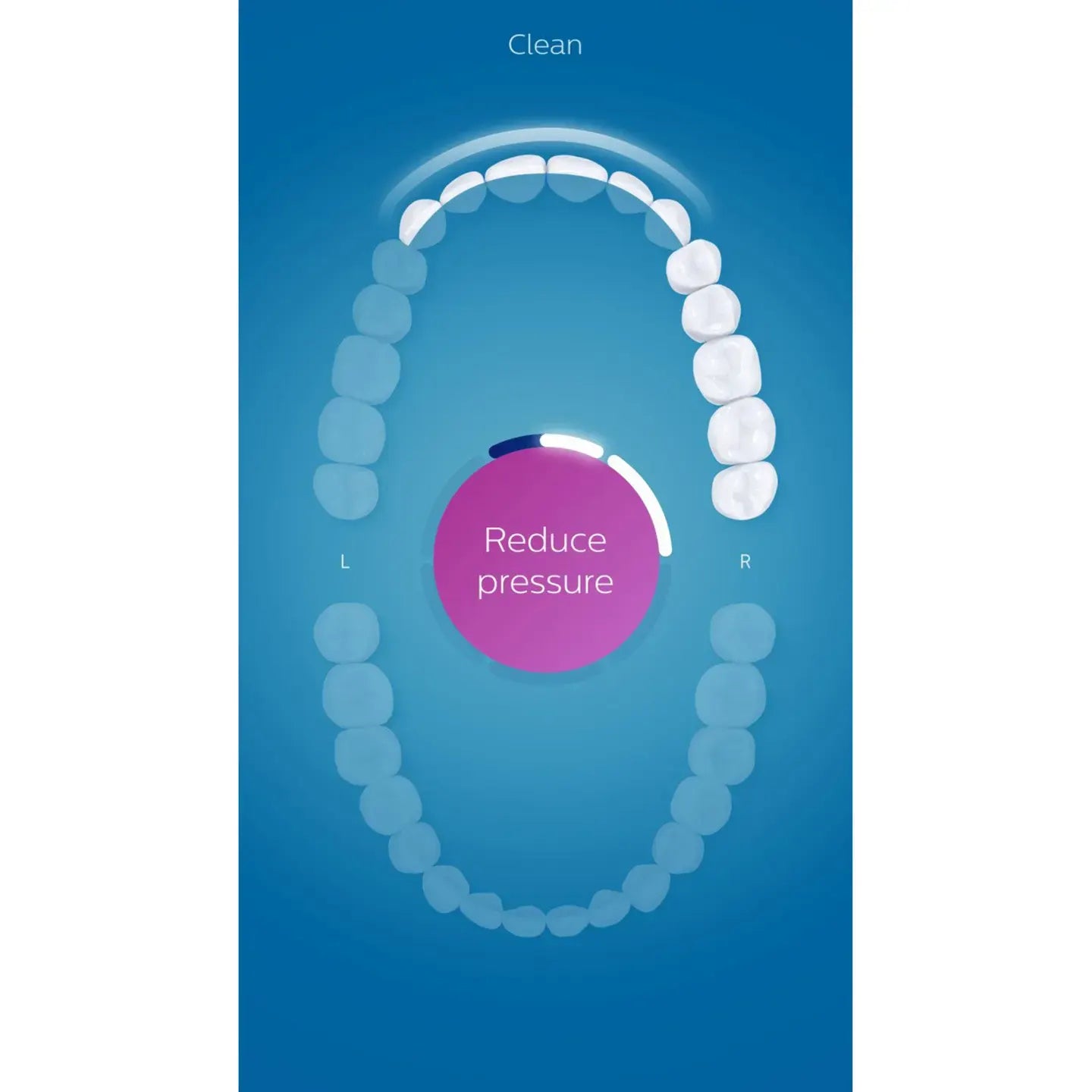 Philips Sonicare Diamond Clean Rechargeable Toothbrush-Rose GOLD [Hx9312/04]